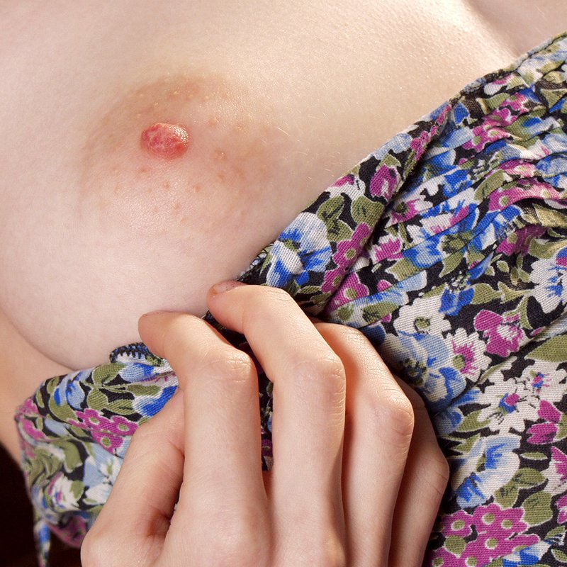 Rencontre coquine berna